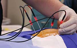 Pain Management Procedure Video Services